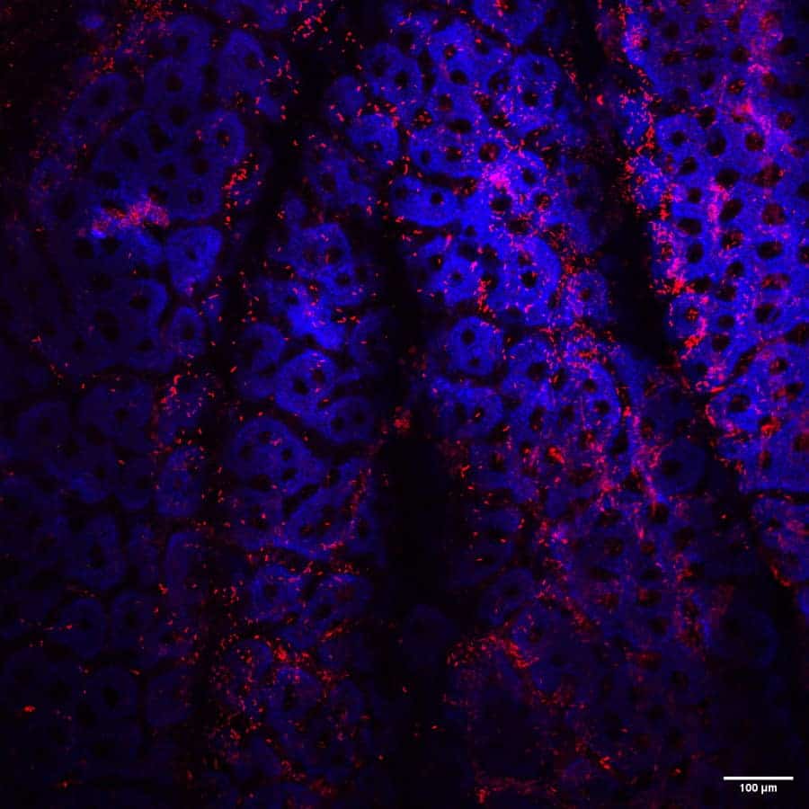 Interaction of C. difficile with the mucosa - BaPs