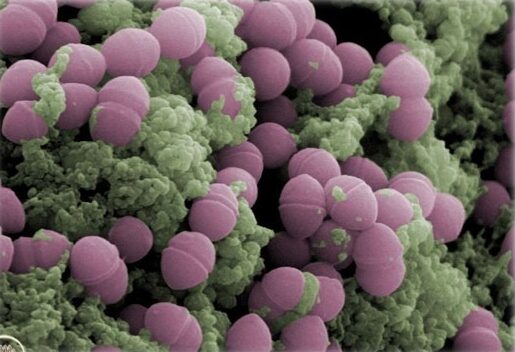 S. thermophilus in a food matrix (SEM - ©T. Meylheuc, MiMa2, INRAE)