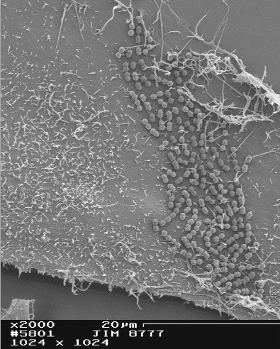 Interactions of Streptococcus salivarius with host intestinal epithelial cells (Electron microscopy by Rhode M ., Germany).