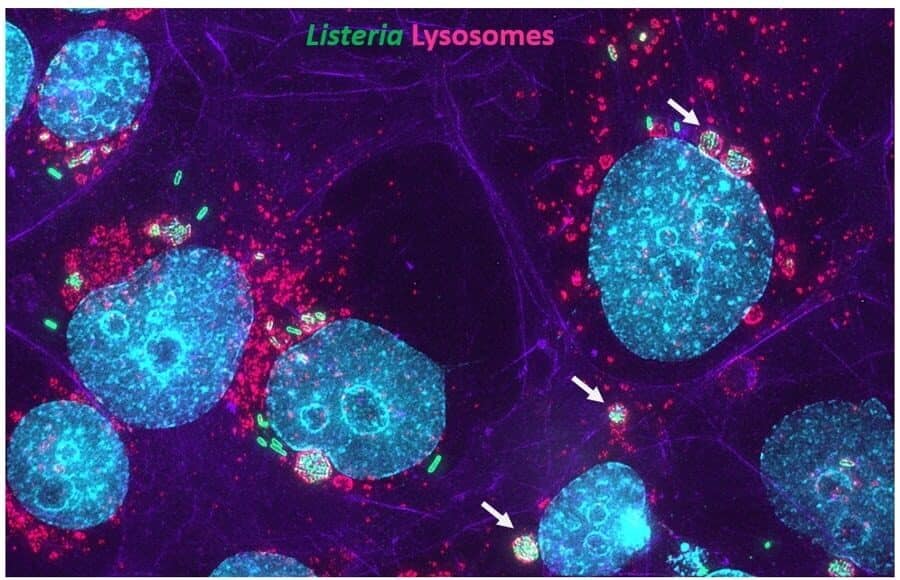 Persistent and VBNC state of L. monocytogenes inside intracellular vacuoles - EPIMIC