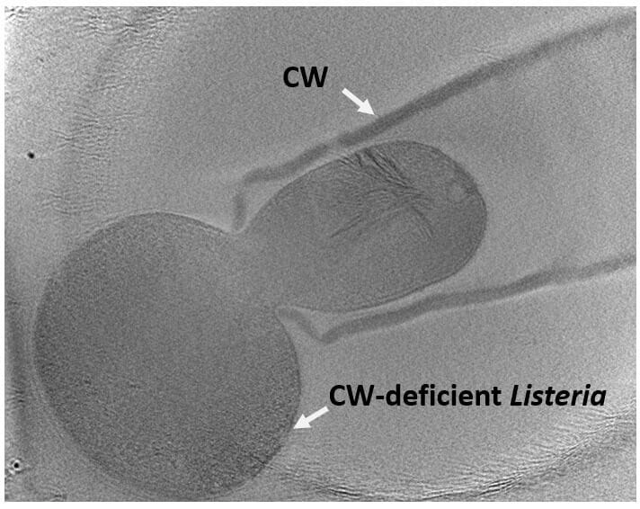 The VBNC state of L. monocytogenes - EPIMIC