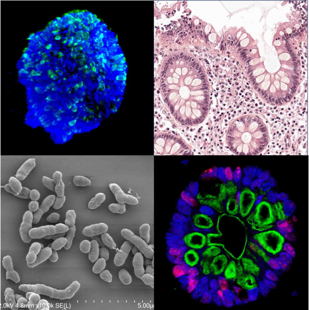 Commensal and Probiotic Microorganisms-Host Interactions / ProbiHôte